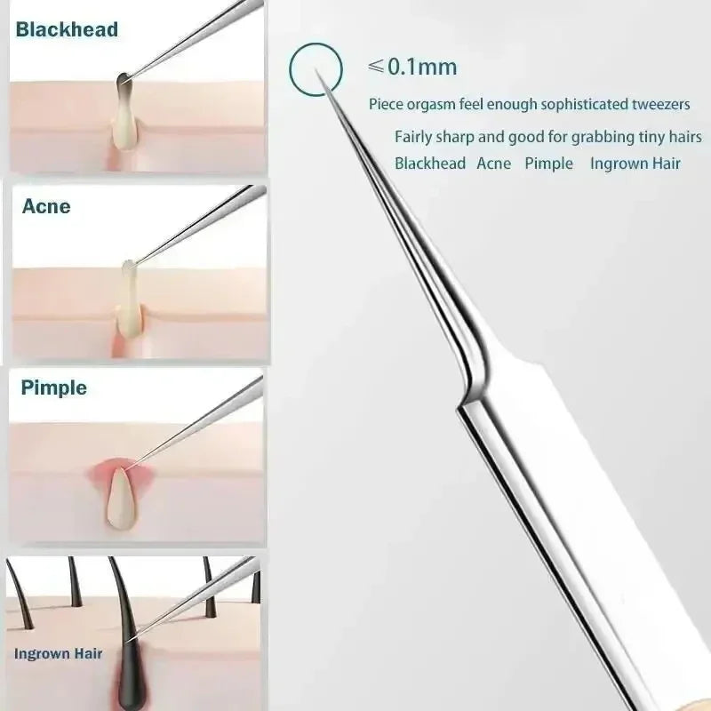 11Pcs Pro Acne Needles Blackhead Remover Ultra-fine No. 5 Cell Clips Pimples Tweezers Facial Pore Cleaning Face Skin Care Tools free Gift laptop stand