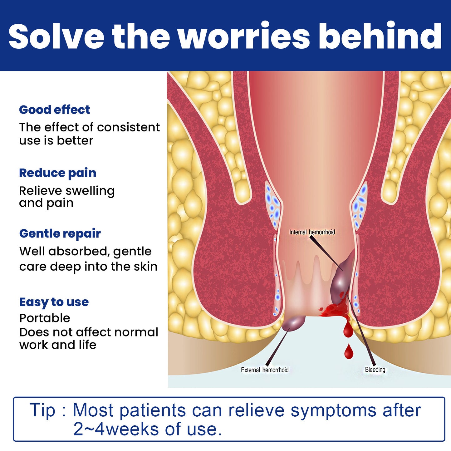 Hemorrhoid Cream Meat Ball Anti Itching Cold Compress Soothing Repair Gel