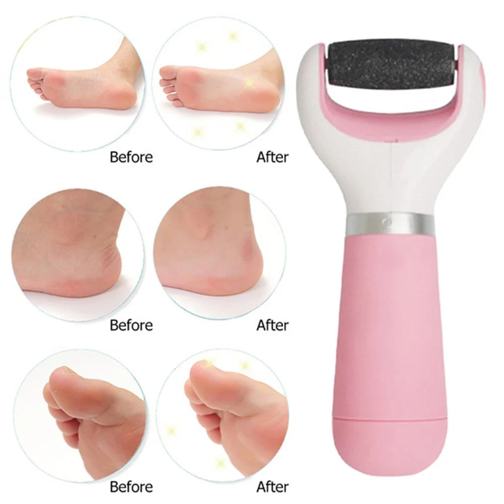 Electric Foot File Dead Skin Heel Callus Remover Esfoliante Foot Peel Feet Care Foot Grinding Machine Pedicure Tools Profession