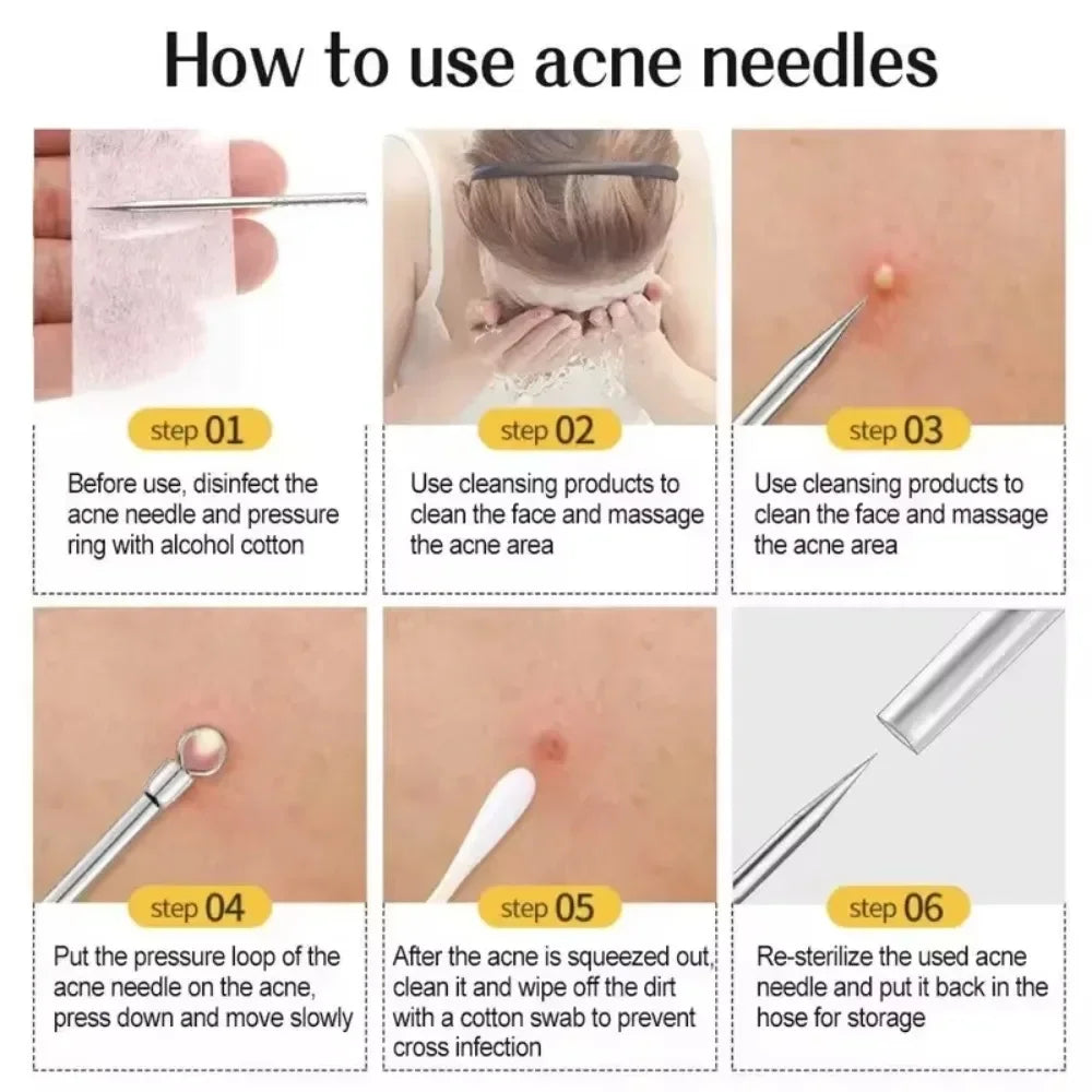 11Pcs Pro Acne Needles Blackhead Remover Ultra-fine No. 5 Cell Clips Pimples Tweezers Facial Pore Cleaning Face Skin Care Tools free Gift laptop stand