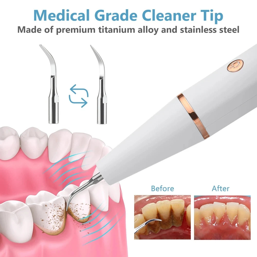 Ultrasonic Dental Scaler Cleaning Tartar Dental Whitening Calculus Devices Eliminator Remover Ultra Electic Sonic Tooth Cleaner