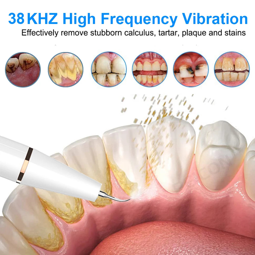 Ultrasonic Dental Tartar Remover Electric Ultra Sonic Dental Calculus Remover Plaque Removal Dental Scaler Tartar Eliminator